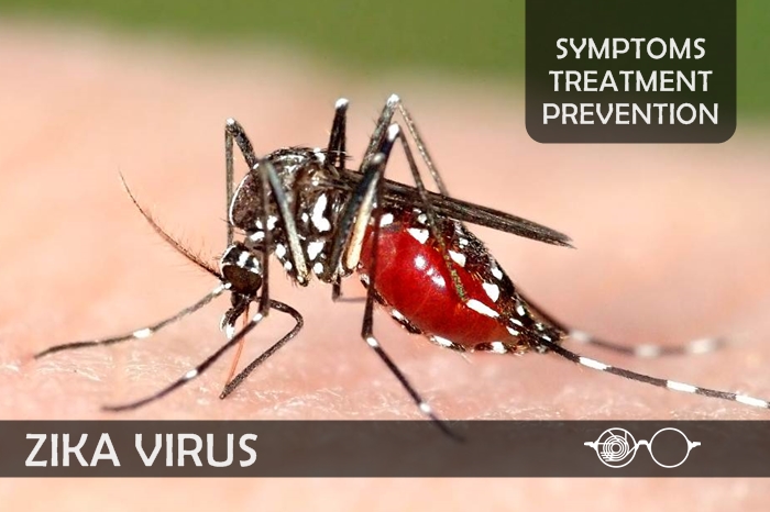 Zika Virus – Symptoms, Treatment & Prevention